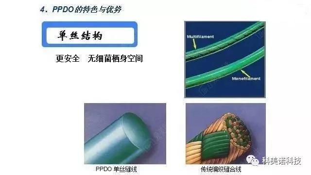 你要了解的PPDO线雕技术，都在这儿了！