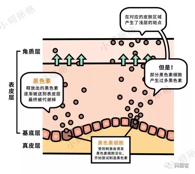 脸蛋已经长了斑？这是你应该做的第一件事...