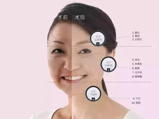 你知道五千块线雕跟五万块线雕的区别吗？